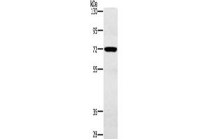 Gel: 6 % SDS-PAGE, Lysate: 40 μg, Lane: Mouse heart tissue, Primary antibody: ABIN7191964(POU6F2 Antibody) at dilution 1/200, Secondary antibody: Goat anti rabbit IgG at 1/8000 dilution, Exposure time: 30 seconds (POU6F2 antibody)