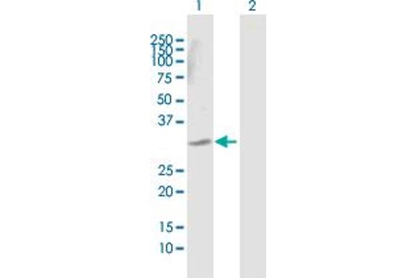 DECR2 antibody  (AA 1-292)