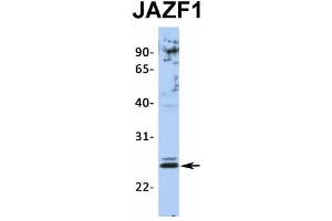 Host:  Rabbit  Target Name:  JAZF1  Sample Type:  Jurkat  Antibody Dilution:  1. (JAZF1 antibody  (N-Term))