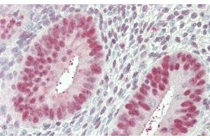 Immunohistochemistry (IHC) image for anti-Nucleolin (NCL) (AA 388-569) antibody (ABIN7434773)