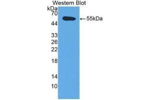 Detection of Recombinant TFPI, Human using Monoclonal Antibody to Tissue Factor Pathway Inhibitor (TFPI) (TFPI antibody  (AA 29-251))