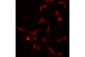 ABIN6267512 staining 293 by IF/ICC. (STAT5A antibody  (pSer780))