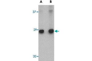 ELOVL6 antibody  (C-Term)