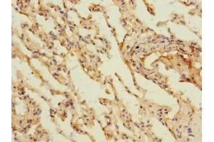 Immunohistochemistry of paraffin-embedded human lung tissue using ABIN7158886 at dilution of 1:100
