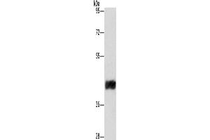 Western Blotting (WB) image for anti-Cysteine-Rich with EGF-Like Domains 2 (CRELD2) antibody (ABIN2429825) (CRELD2 antibody)
