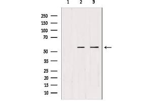Western blot analysis of extracts from various samples, using CDKL2 Antibody. (CDKL2 antibody  (Internal Region))