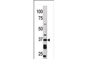 Western blot analysis of anti-ART1 Pab in HepG2 cell line lysate (35ug/lane)