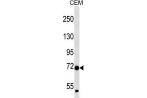 Western Blotting (WB) image for anti-Zinc Finger Protein 443 (ZNF443) antibody (ABIN2997281) (ZNF443 antibody)