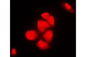 Immunofluorescent analysis of XPO2 staining in NIH3T3 cells. (Exportin 2 antibody  (N-Term))