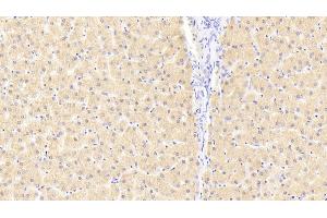 Detection of FKBPL in Human Liver Tissue using Polyclonal Antibody to FK506 Binding Protein Like Protein (FKBPL) (FKBPL antibody  (AA 1-349))