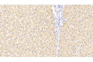 Detection of FKBPL in Human Liver Tissue using Polyclonal Antibody to FK506 Binding Protein Like Protein (FKBPL) (FKBPL antibody  (AA 1-349))
