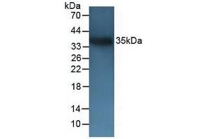 Figure. (CD72 antibody  (AA 143-345))