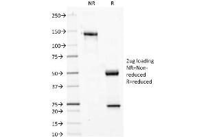 SDS-PAGE Analysis Purified Phosphotyrosine Mouse Monoclonal Antibody (PY20). (Phosphotyrosine antibody)