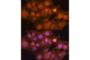 Immunofluorescence analysis of C6 cells using MDM2 antibody (ABIN6133186, ABIN6143671, ABIN6143672 and ABIN6217278) at dilution of 1:100. (MDM2 antibody  (AA 200-430))