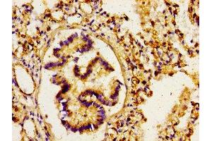 Immunohistochemistry of paraffin-embedded human lung tissue using ABIN7167915 at dilution of 1:100 (ARHGAP1 antibody  (AA 216-308))