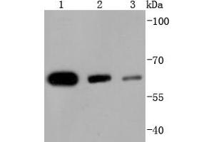 Lane 1: HeLa Cell lysates, Lane 2: Jurkat Cell lysates, Lane 3: K562 cell lysates, probed with HDAC1 (3C3) Monoclonal Antibody  at 1:1000 overnight at 4˚C. (HDAC1 antibody)