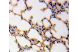 IHC-P analysis of Lung tissue, with DAB staining. (Calmodulin 1 antibody  (AA 2-149))