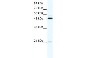 Western Blotting (WB) image for anti-Tumor Necrosis Factor Receptor Superfamily, Member 11b (TNFRSF11B) (N-Term) antibody (ABIN2792104)