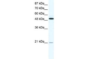 WB Suggested Anti-TNFRSF11B Antibody Titration:  1.