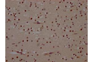 Immunohistochemistry (IHC) image for anti-Mitogen-Activated Protein Kinase 14 (MAPK14) antibody (ABIN7127654)