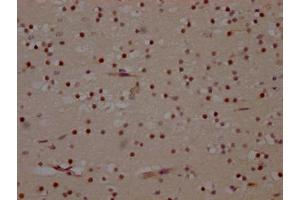 IHC image of ABIN7127654 diluted at 1:100 and staining in paraffin-embedded human brain tissue performed on a Leica BondTM system. (Recombinant MAPK14 antibody)