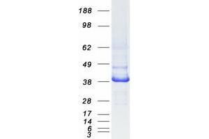 Validation with Western Blot