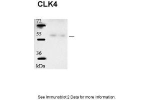 Sample type: human microvascular endothelial cells (25ug)Primary Dilution: 1:1000Secondary Antibody: Goat anti-Rabbit-HRPSecondary Dilution: 1:5000Image Submitted by: Andreas Eisenreich Charite Universitatsmedizin Berlin (CLK4 antibody  (N-Term))