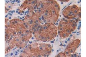 DAB staining on IHC-P; Samples: Human Stomach Tissue (IRAK1 antibody  (AA 212-440))