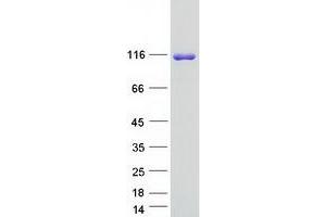 SH3PXD2B Protein (Myc-DYKDDDDK Tag)