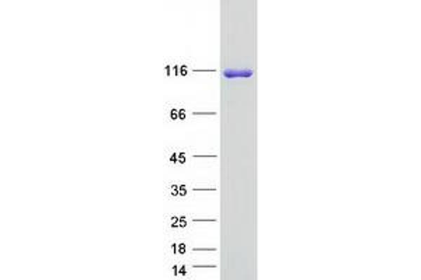 SH3PXD2B Protein (Myc-DYKDDDDK Tag)