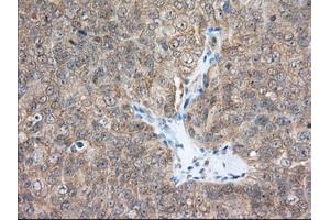 Immunohistochemical staining of paraffin-embedded Human Kidney tissue using anti-ACAT2 mouse monoclonal antibody.
