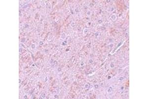 Immunohistochemistry (IHC) image for anti-Protein Inhibitor of Activated STAT, 2 (PIAS2) (N-Term) antibody (ABIN1031511) (PIAS2 antibody  (N-Term))
