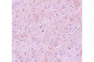 Immunohistochemistry (IHC) image for anti-Protein Inhibitor of Activated STAT, 2 (PIAS2) (N-Term) antibody (ABIN1031511)