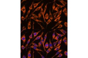 Immunofluorescence analysis of L929 cells using SNX15 antibody  at dilution of 1:100. (SNX15 antibody  (AA 1-342))