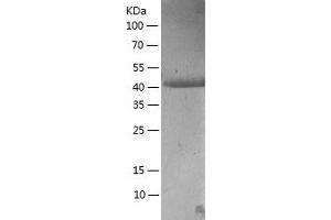 Western Blotting (WB) image for Bromodomain Containing 3 (BRD3) (AA 29-417) protein (His tag) (ABIN7122049)