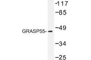 Image no. 1 for anti-Golgi Reassembly Stacking Protein 2, 55kDa (GORASP2) antibody (ABIN317911) (GORASP2 antibody)