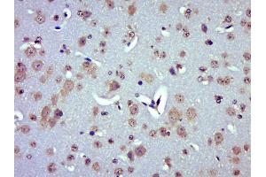 Paraformaldehyde-fixed, paraffin embedded Mouse brain Antigen retrieval by boiling in sodium citrate buffer (pH6. (UCP2 antibody  (AA 201-309))