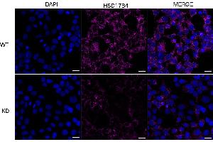 Immunocytochemical staining of HeLa cells using HSD17B4 antibody (ABIN7799015), 1:1,000), Top panel: wild-type (WT), Bottom panal: HSD17B4 shRNA knockdown (KD). (HSD17B4 antibody)