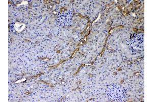IHC analysis of GALE using anti-GALE antibody . (GALE antibody  (AA 1-340))