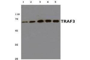 Western blot analysis of TRAF3 antibody at 1/500 dilution.