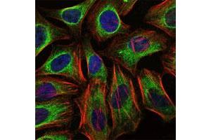 Immunofluorescence analysis of HeLa cells using CBL monoclonal antibody, clone 3B12  (green). (CBL antibody)
