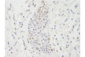 Immunohistochemistry (IHC) image for anti-Suppressor of Ty 6 Homolog (SUPT6H) (AA 425-475) antibody (ABIN7448820) (Spt6 antibody  (AA 425-475))