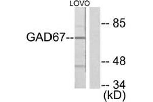 Western blot analysis of extracts from LOVO cells, using GAD1 Antibody. (GAD antibody  (AA 471-520))
