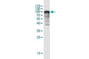 Western Blot detection against Immunogen (95. (Endoglin antibody  (AA 27-658))