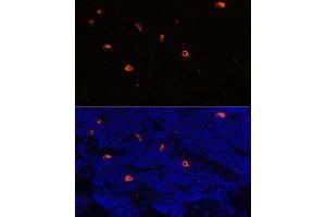 Immunofluorescence analysis of rat bone marrow using CAMP antibody (ABIN7266146) at dilution of 1:100. (Cathelicidin antibody  (AA 31-170))