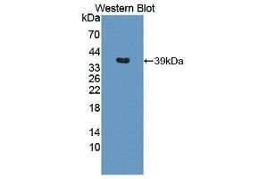 Western Blotting (WB) image for anti-Interleukin 12 beta (IL12B) (AA 23-329) antibody (ABIN1868565) (IL12B antibody  (AA 23-329))