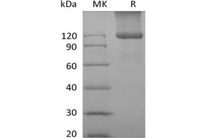 Western Blotting (WB) image for Transforming Growth Factor, beta Receptor III (TGFBR3) protein (His tag) (ABIN7320903) (TGFBR3 Protein (His tag))