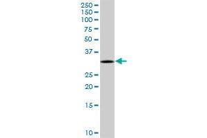 TREX1 MaxPab rabbit polyclonal antibody. (TREX1 antibody  (AA 1-369))