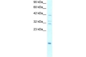 Western Blotting (WB) image for anti-Nuclear Factor of kappa Light Polypeptide Gene Enhancer in B-Cells Inhibitor, alpha (NFKBIA) antibody (ABIN2463859) (NFKBIA antibody)