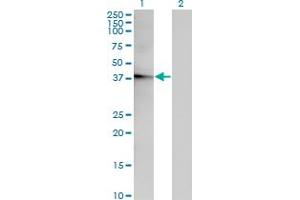 Western Blotting (WB) image for anti-Acyl-CoA Thioesterase 7 (ACOT7) (AA 1-338) antibody (ABIN524744)
